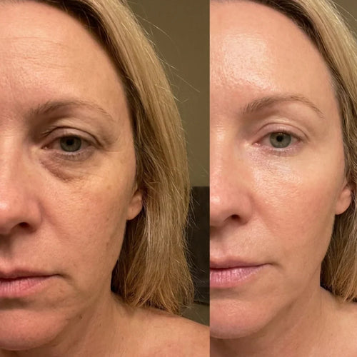 Month 3